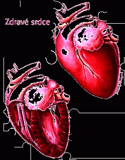 HCM (Feline Hypertrophe Cardiomyopathia)